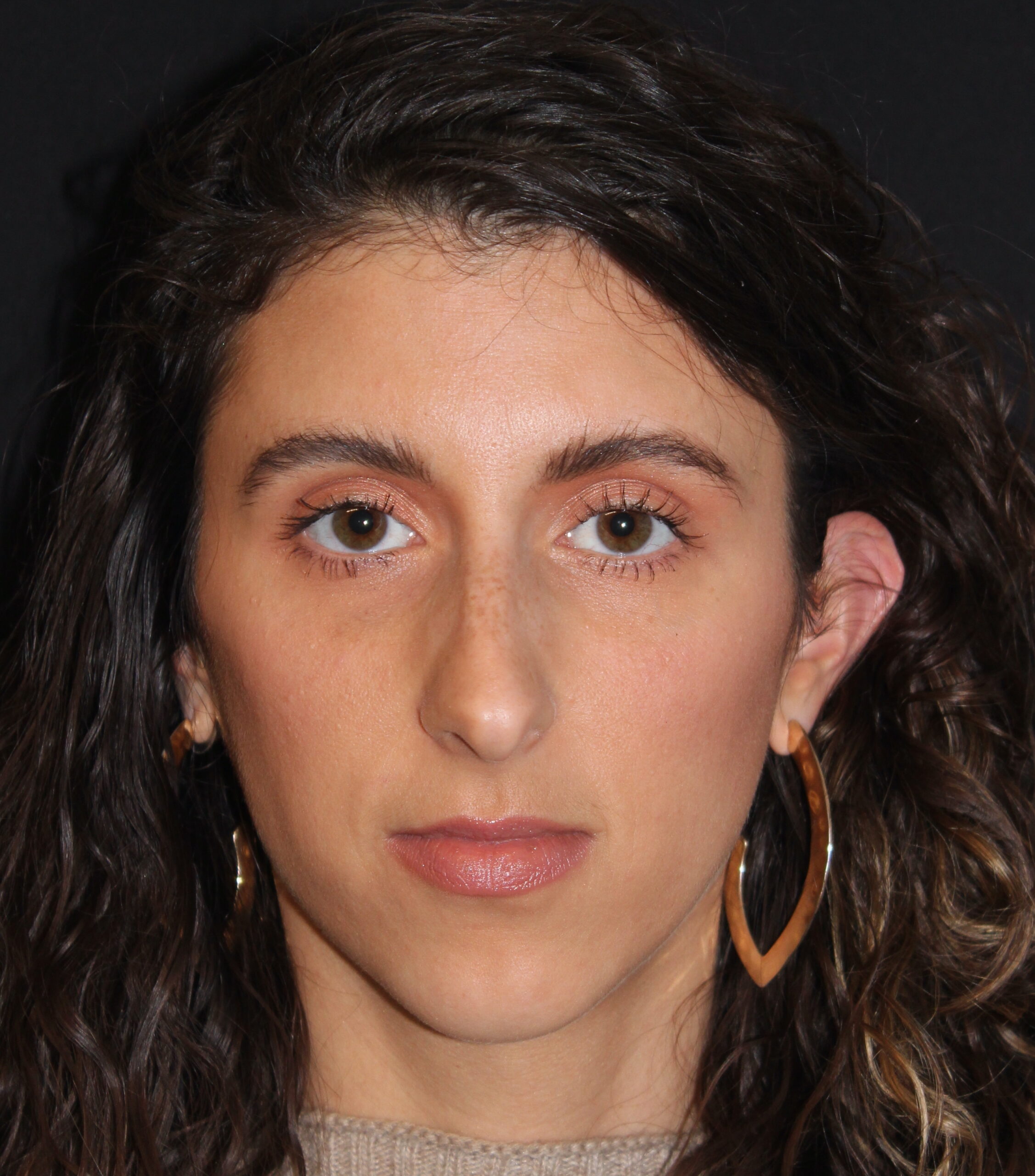 Patient 104 Before Image