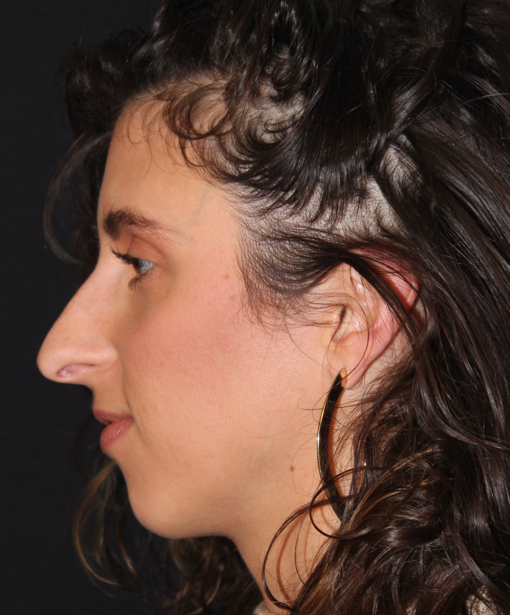 Patient 104 Before Image