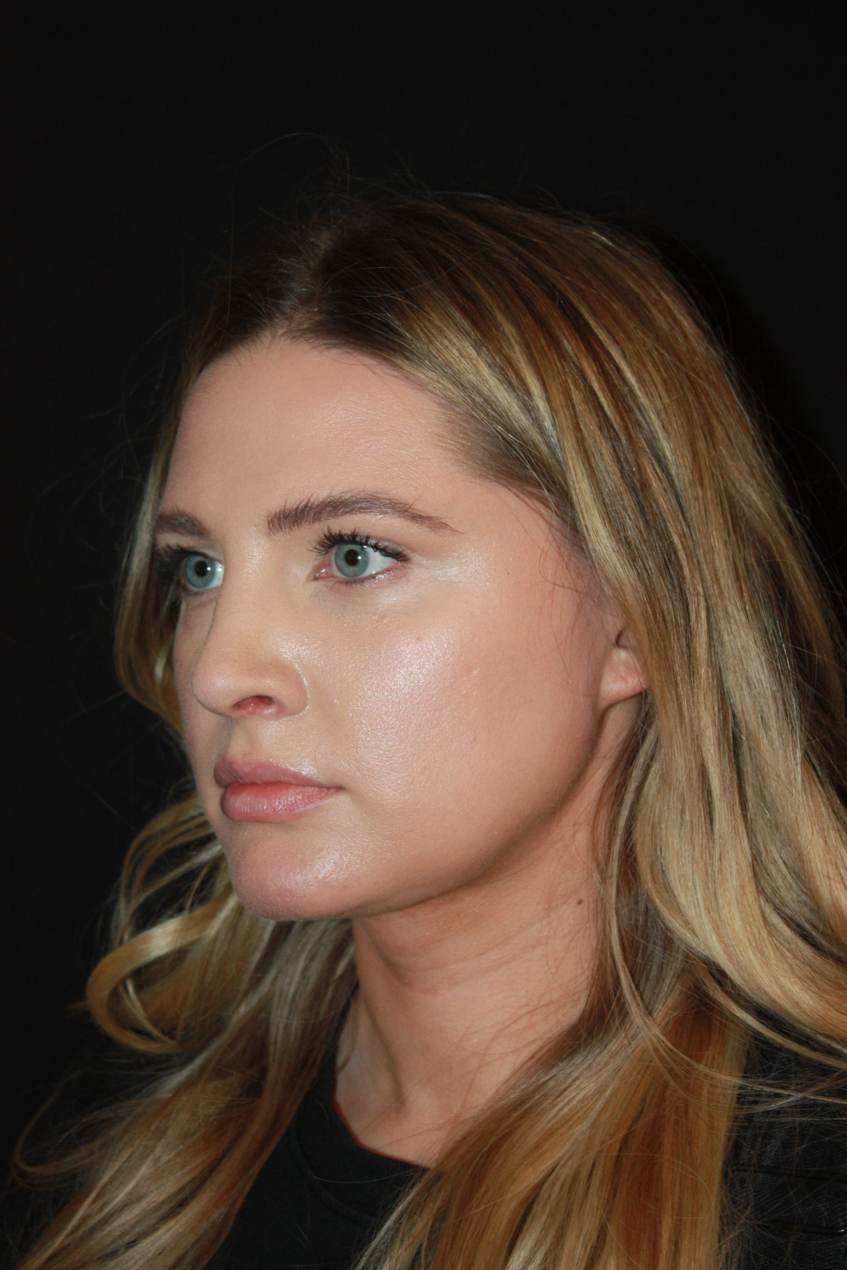 Patient 62 After Image