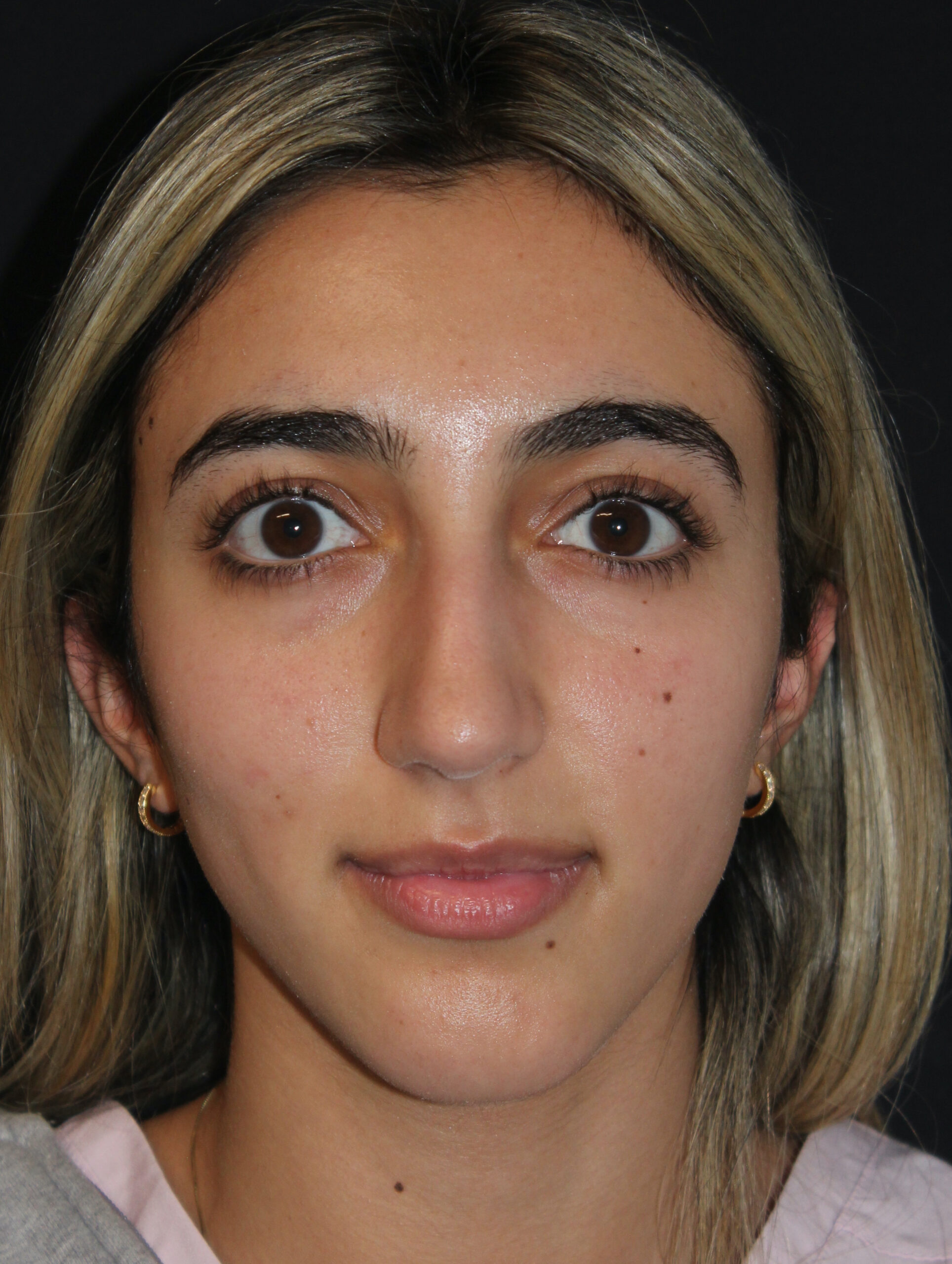 Patient #118 Before Image