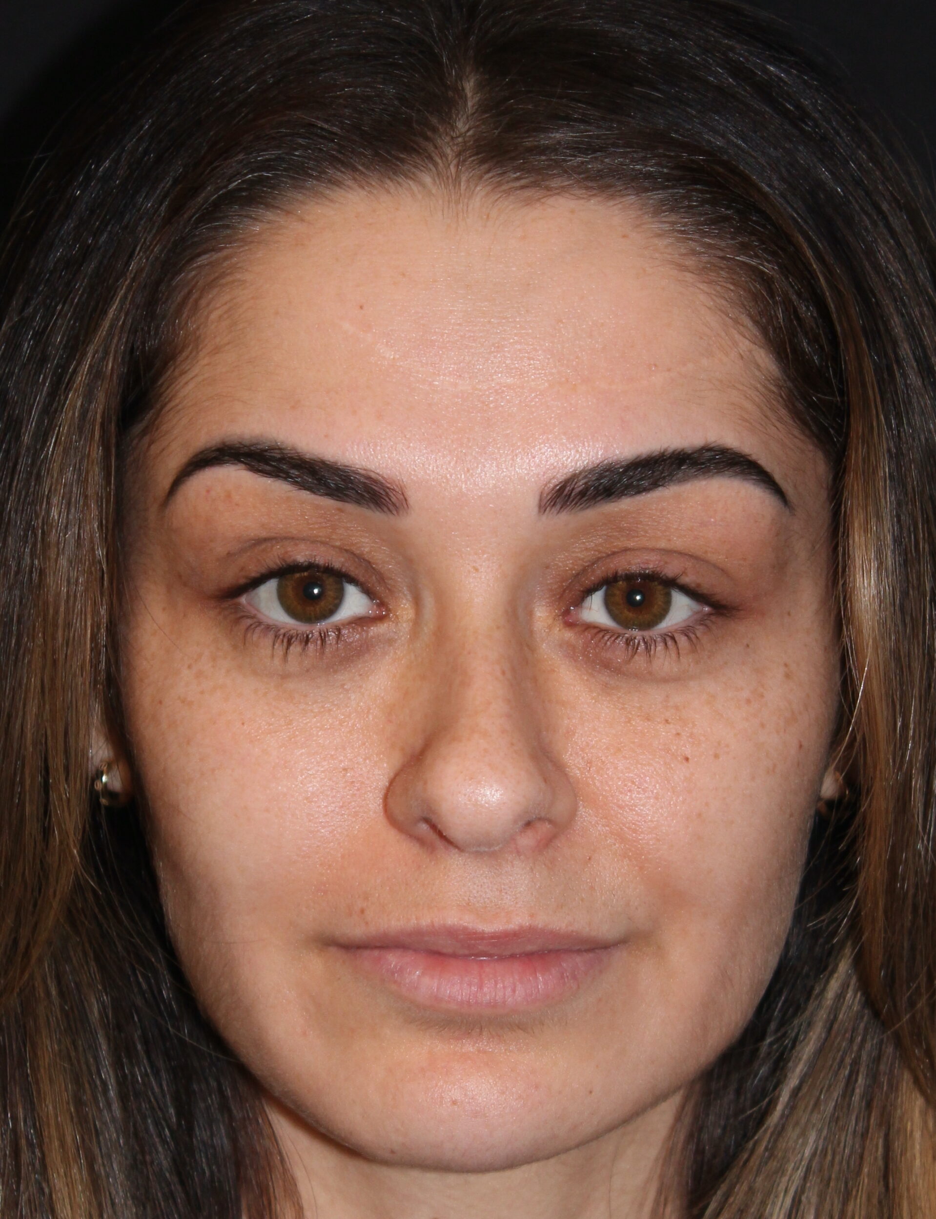 Patient #179 Before Image