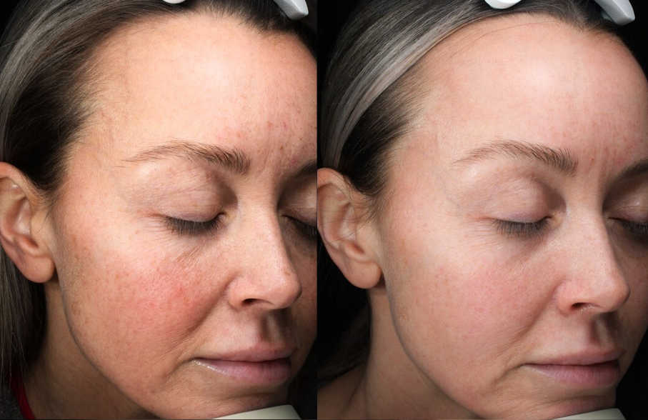 Patient #173 Marge Image