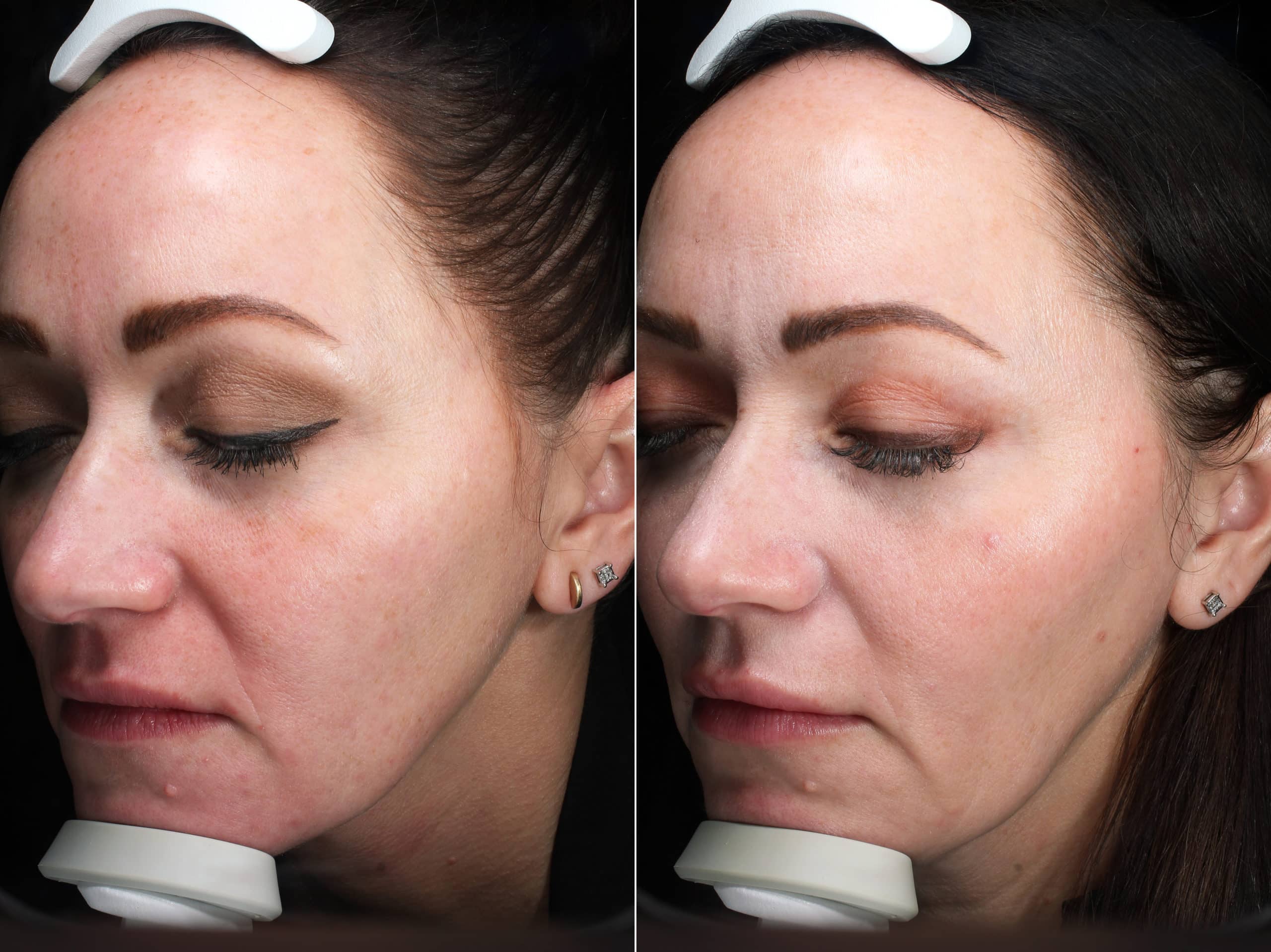 Patient 86 Marge Image