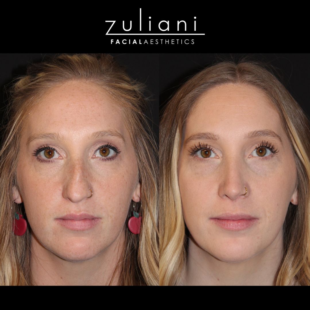 Patient #133 Marge Image