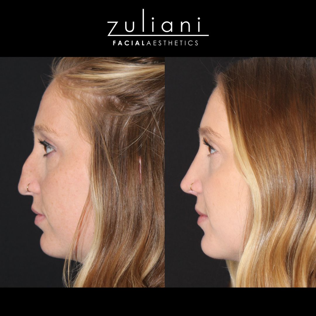 Patient #133 Marge Image