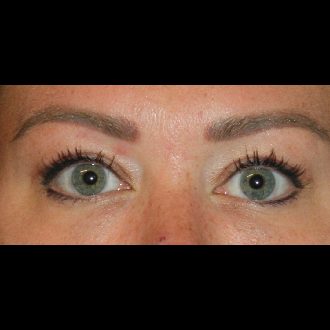 Patient 67 After Image