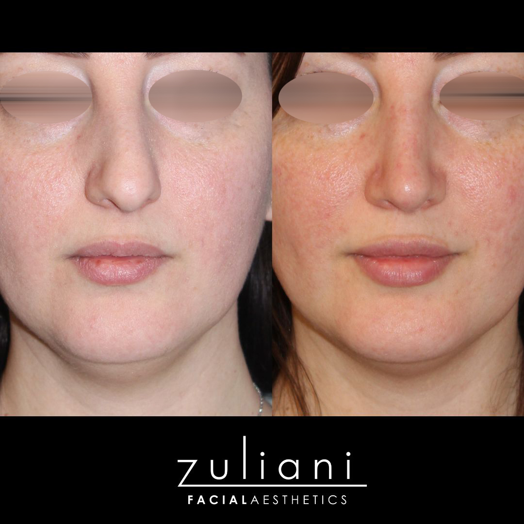 Patient #177 Marge Image