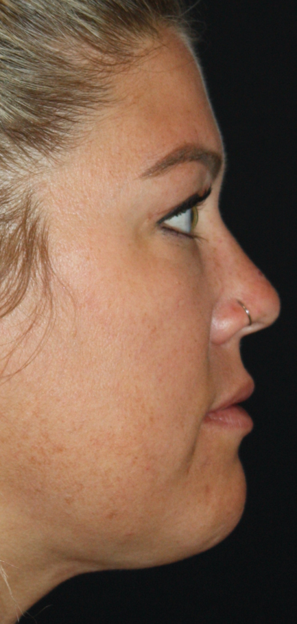 Patient 66 After Image