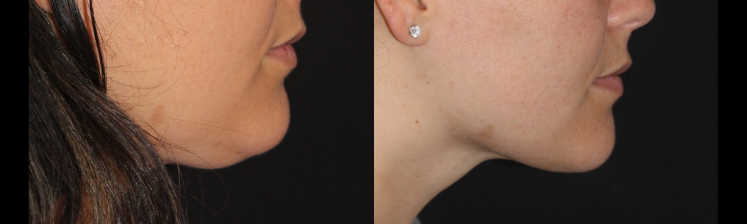 Patient #141 Marge Image