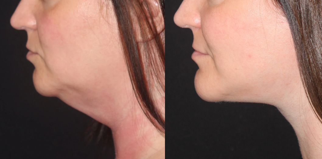 Patient #124 Marge Image