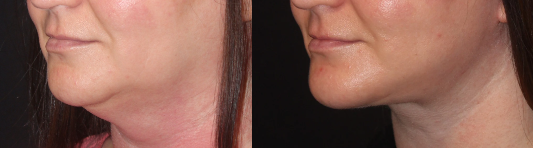 Patient #124 Marge Image