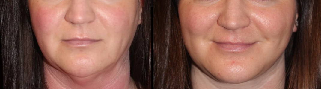 Patient #124 Marge Image