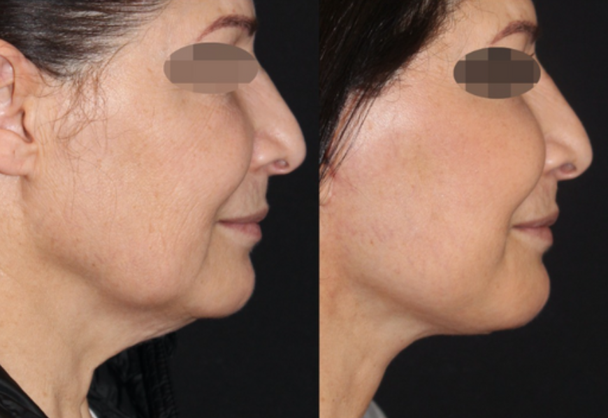 Patient #125 Marge Image