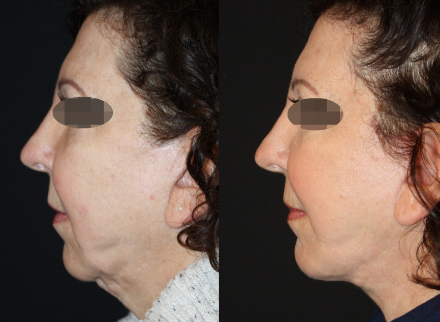 Patient #123 Marge Image