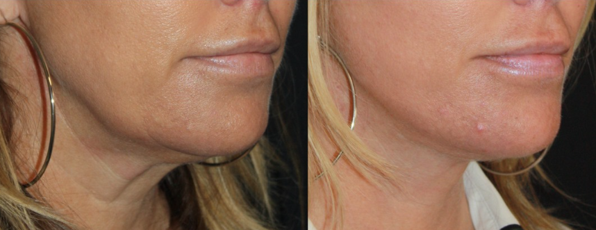 Patient #126 Marge Image