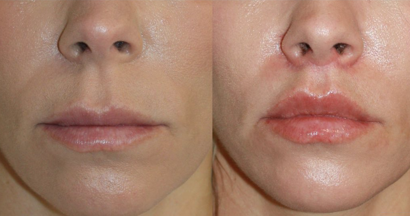 Patient #130 Marge Image