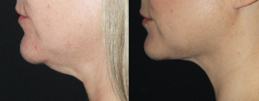 Patient #129 Marge Image