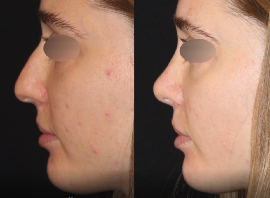 Patient #111 Marge Image