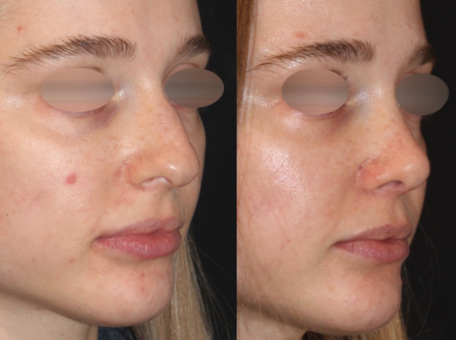 Patient #111 Marge Image