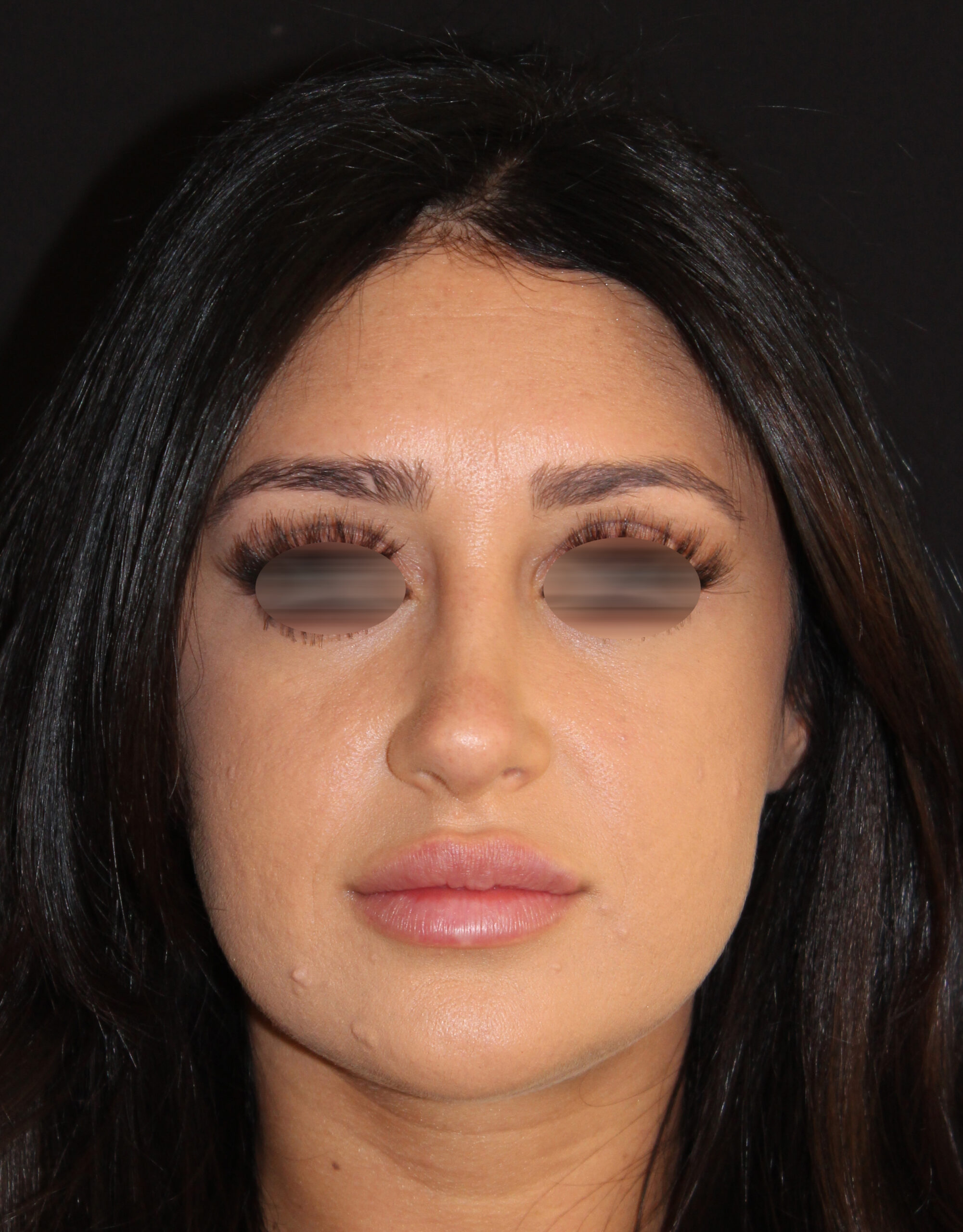 Patient #131 After Image