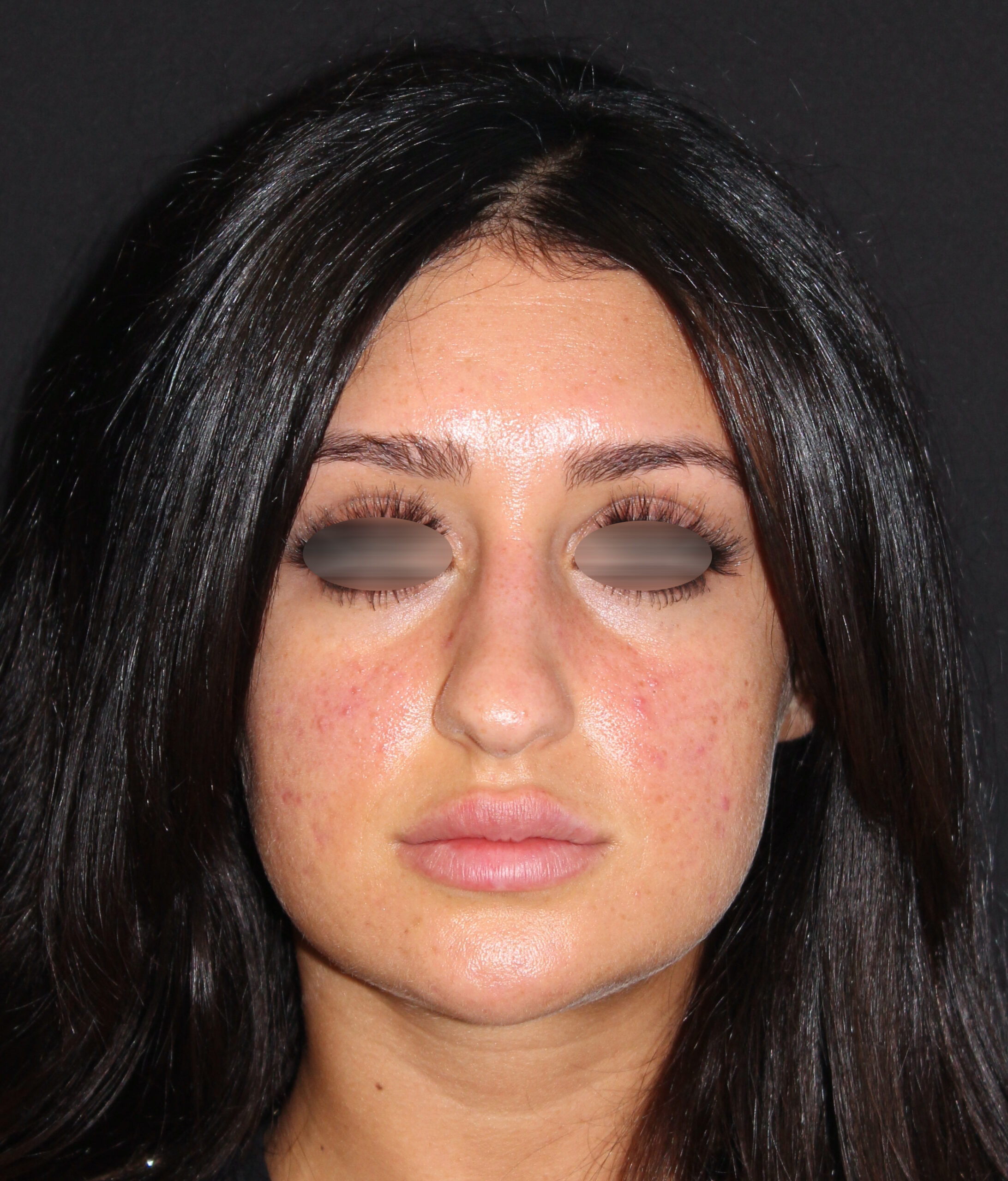 Patient #131 Before Image