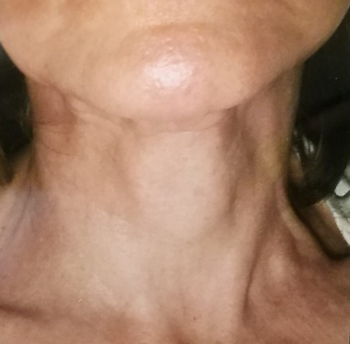 Patient 16 After Image