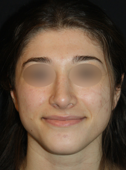 Patient 58 After Image