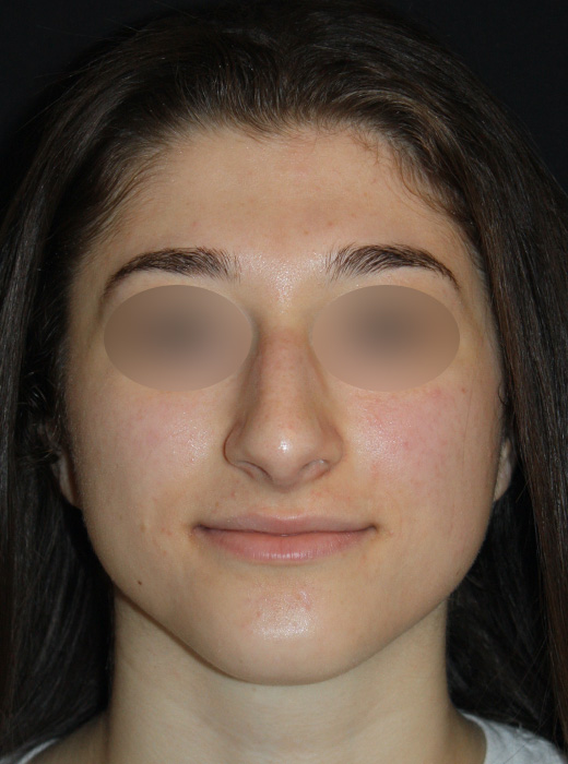 Patient 58 Before Image