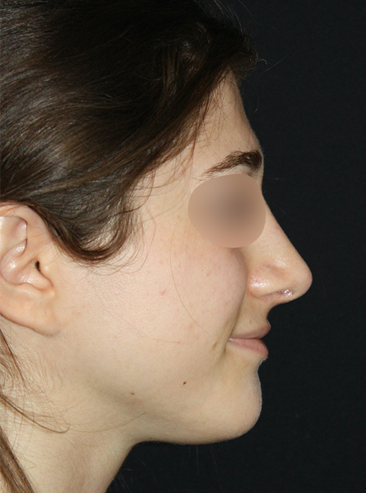 Patient 58 After Image