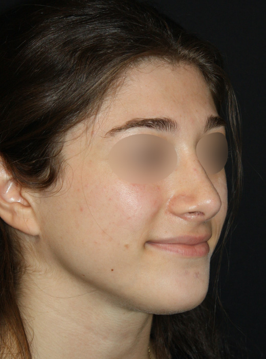 Patient 58 After Image