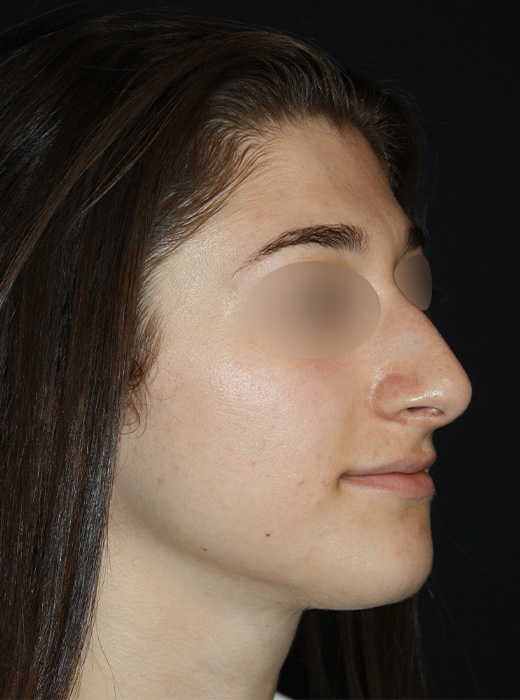 Patient 58 Before Image