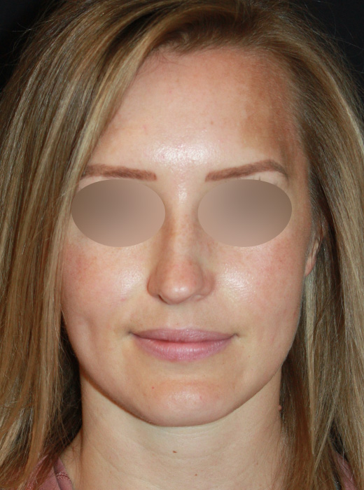 Patient 72 Before Image