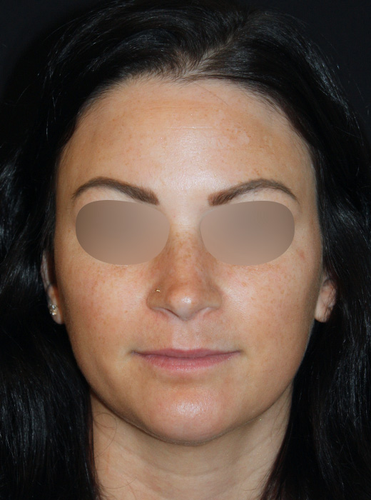 Patient 77 Before Image