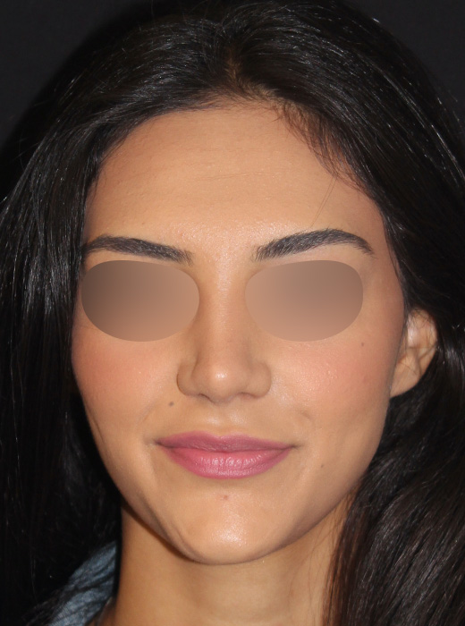 Patient 83 After Image