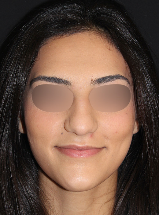 Patient 83 Before Image