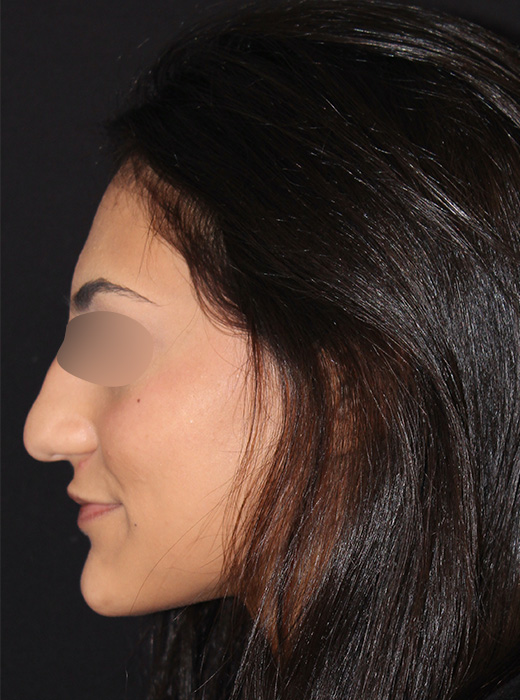 Patient 83 Before Image