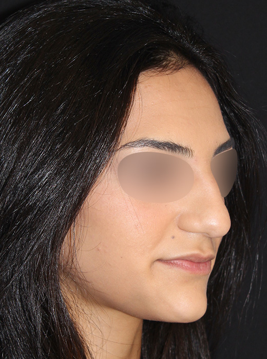 Patient 83 Before Image