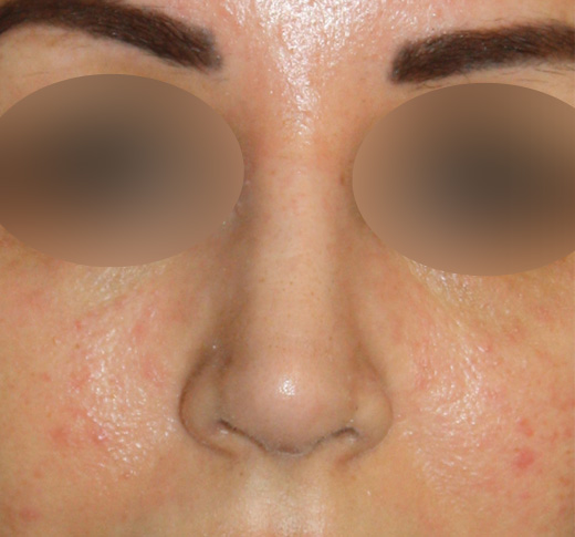 Patient 63 After Image