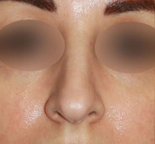 Patient 63 Before Image