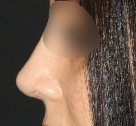 Patient 63 After Image