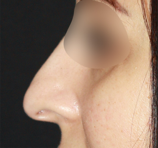Patient 63 Before Image