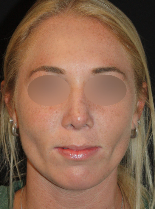 Patient 65 After Image