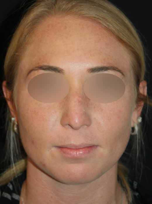 Patient 65 Before Image