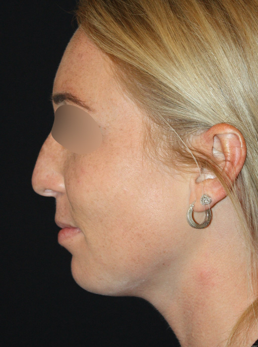Patient 65 Before Image