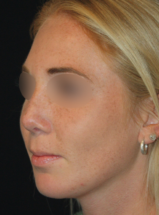 Patient 65 After Image