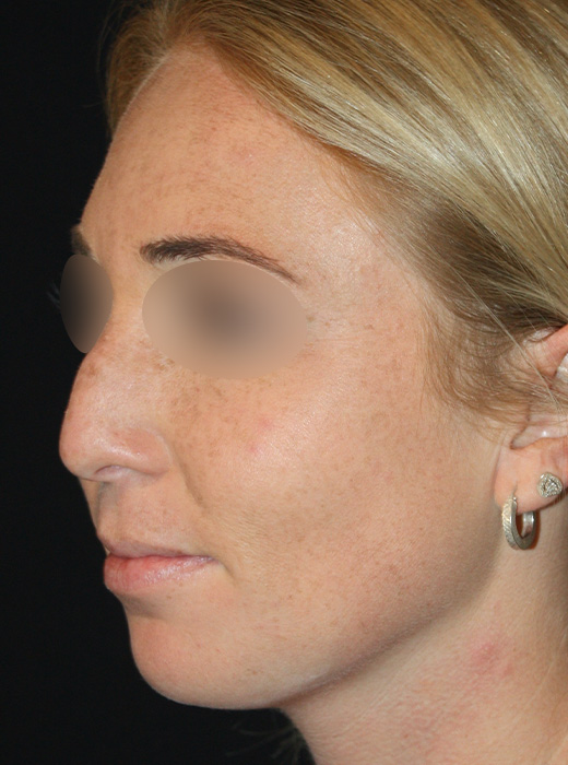 Patient 65 Before Image