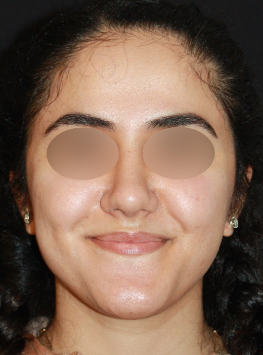 Patient 69 After Image