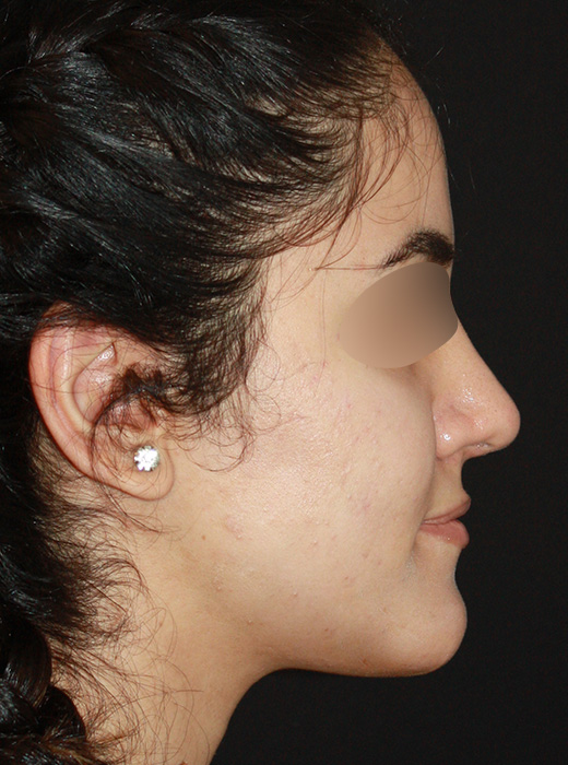 Patient 69 After Image