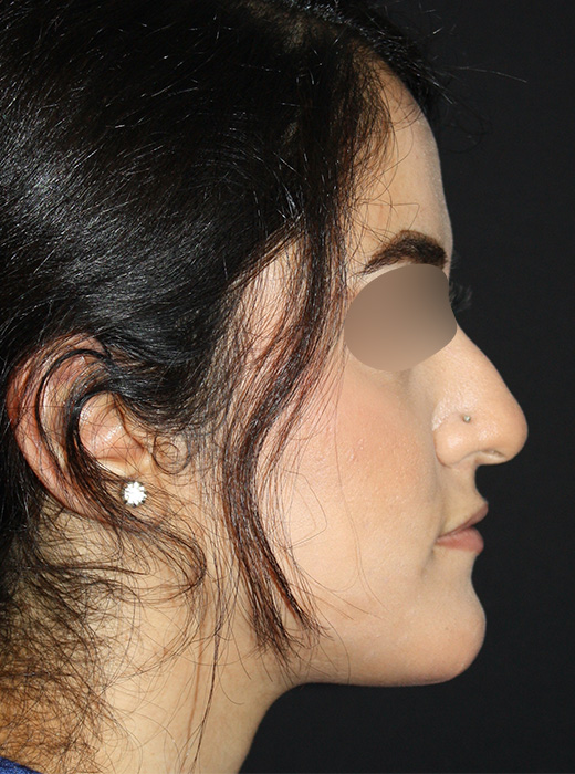 Patient 69 Before Image