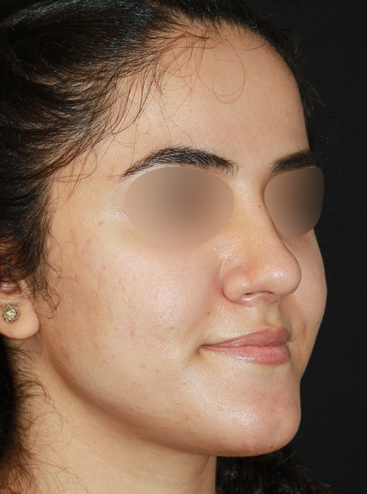 Patient 69 After Image